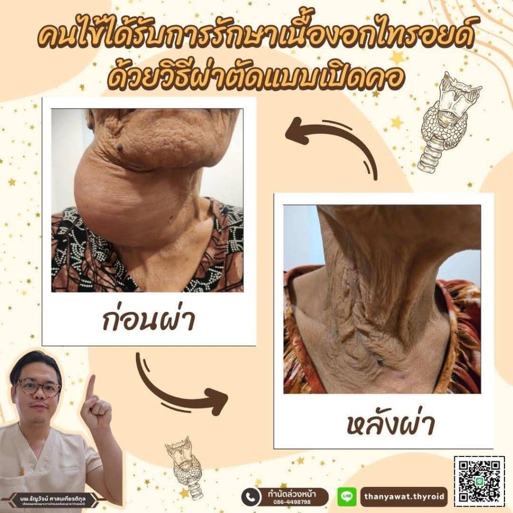 line_oa_chat_250311_171735_group_0-1024x1024