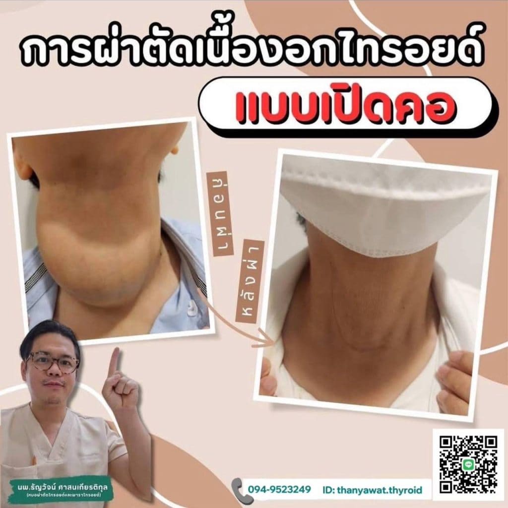 line_oa_chat_250311_171735_group_1-1024x1024
