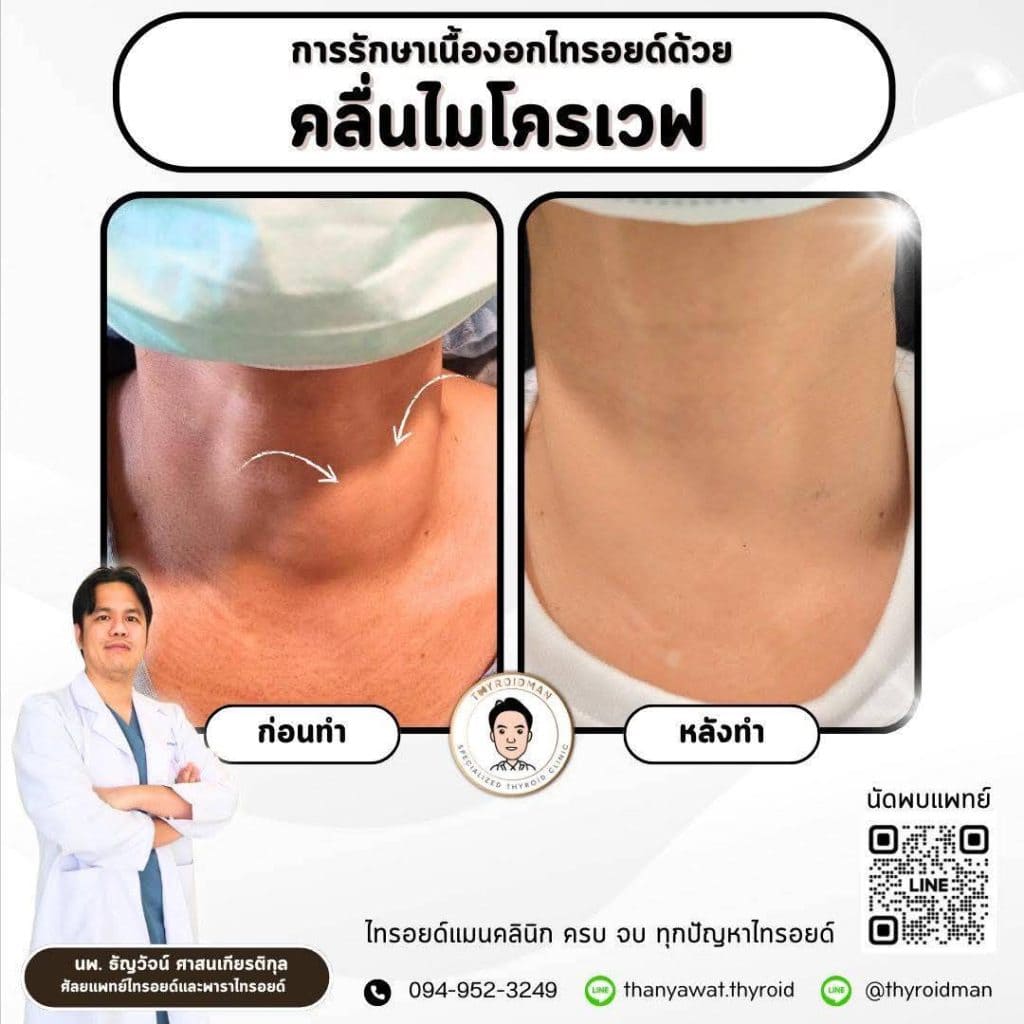 line_oa_chat_250311_171812-1024x1024