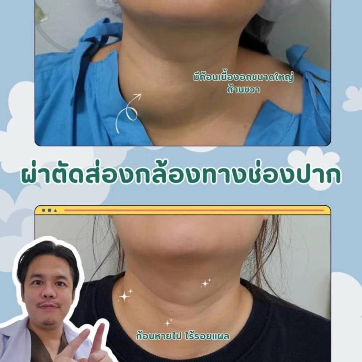 line_oa_chat_250311_171815_group_0-r2zi2xf7klpdl7r28s3jnt4vjsokkp5tlu8ic0qbko